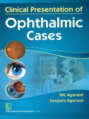 Clinical Presentation of Ophthalmic Cases(English, Paperback, Agarwal M.L. MS FRCS)