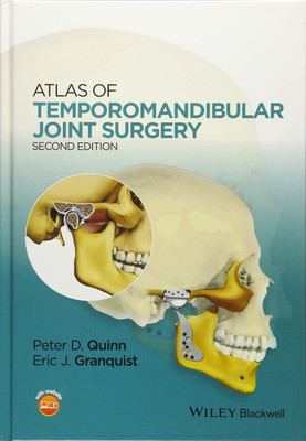 Atlas of Temporomandibular Joint Surgery(English, Hardcover, unknown)