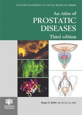 An Atlas of Prostatic Diseases, Third Edition(English, Hardcover, unknown)