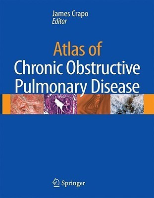 Atlas of Chronic Obstructive Pulmonary Disease(English, Hardcover, unknown)