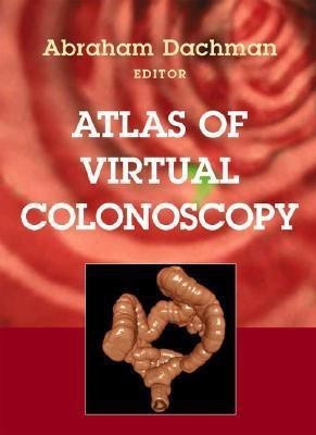 Atlas of Virtual Colonoscopy(English, Hardcover, unknown)