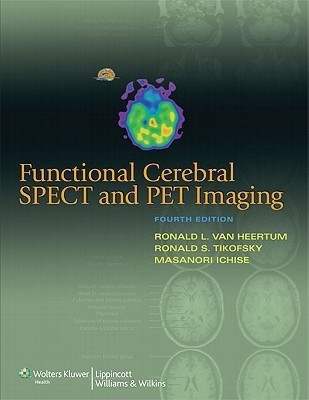 Functional Cerebral SPECT and PET Imaging(English, Hardcover, unknown)