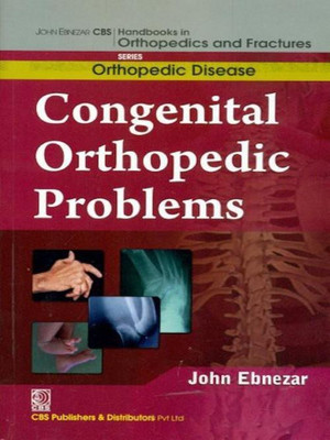 John Ebnezar CBS Handbooks in Orthopedics and Factures: Orthopedic Disease(English, Paperback, Ebnezar John)