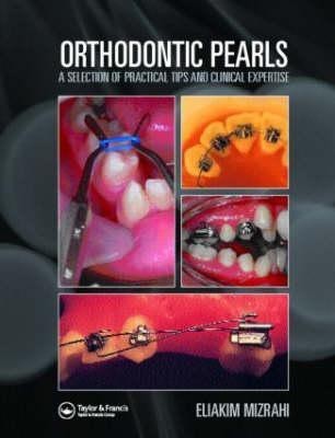 Orthodontic Pearls(English, Hardcover, unknown)