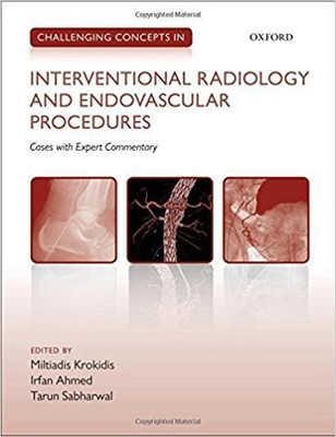 Challenging Concepts in Interventional Radiology(English, Paperback, unknown)