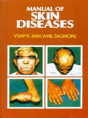 Manual of Skin Diseases(English, Paperback, Jain Deshore)