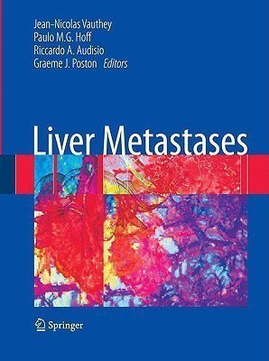 Liver Metastases(English, Hardcover, unknown)