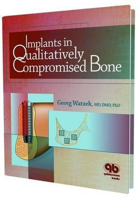 Implants in Qualitatively Compromised Bone(English, Hardcover, unknown)