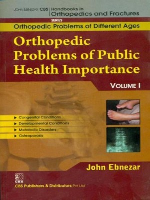 John Ebnezar CBS Handbooks in Orthopedics and Factures: vol. 1(English, Paperback, Ebnezar John)