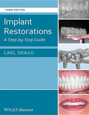 Implant Restorations(English, Hardcover, Drago Carl)
