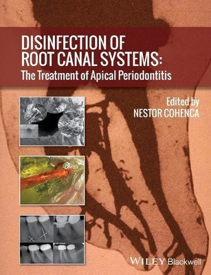 Disinfection of Root Canal Systems(English, Hardcover, unknown)