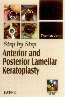 Step by Step Anterior and Post Lamellar Keratoplasty(English, Mixed media product, unknown)