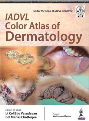 IADVL Color Atlas of Dermatology(English, Hardcover, Vasudevan Biju)