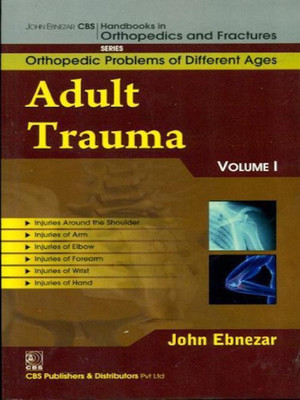 John Ebnezar CBS Handbooks in Orthopedics and Factures: v. 1(English, Paperback, Ebnezar John)