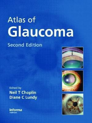 Atlas of Glaucoma, Second Edition(English, Hardcover, unknown)