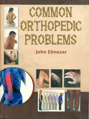 Common Orthopedic Problems(English, Paperback, Ebnezar John)