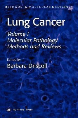 Lung Cancer(English, Hardcover, unknown)