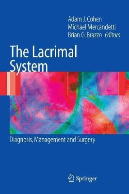 The Lacrimal System 1st Edition(English, Paperback, unknown)