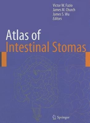 Atlas of Intestinal Stomas(English, Hardcover, unknown)