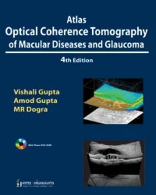 Atlas Optical Coherence Tomography of Macular Diseases and Glaucoma(English, Mixed media product, Gupta Vishali)