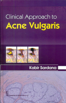 Clinical Approach to Acne Vulgaris(English, Paperback, Kabir Sardana)