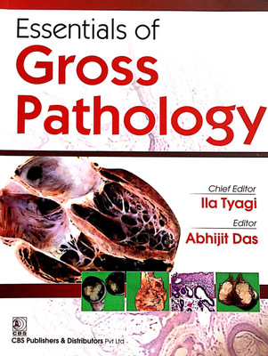Essentials of Gross Pathology(English, Paperback, Tyagi Ila)