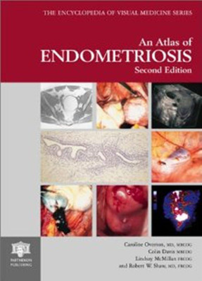 Atlas of Endometriosis(English, Hardcover, unknown)