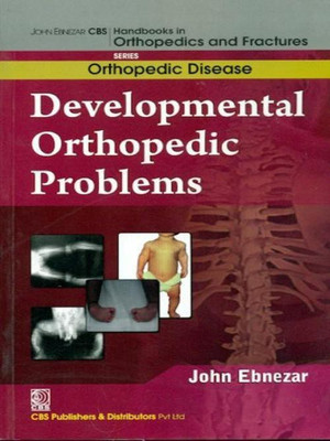 John Ebnezar CBS Handbooks in Orthopedics and Factures: Orthopedic Disease(English, Paperback, Ebnezar John)