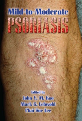 Mild-to-Moderate Psoriasis(English, Hardcover, unknown)