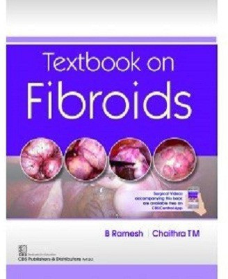 Textbook on Fibroids(English, Paperback, Chaithra T.M.)