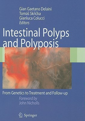 Intestinal Polyps and Polyposis(English, Hardcover, unknown)