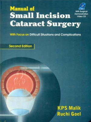 Manual of Small Incision Cataract Surgery(English, Hardcover, Malik K.P.S.)