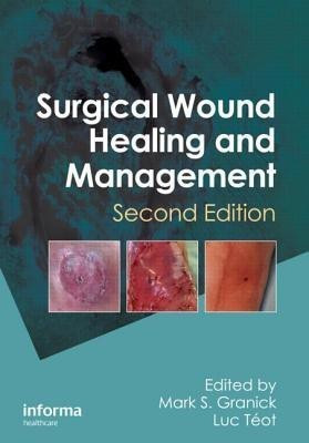 Surgical Wound Healing and Management(English, Hardcover, unknown)