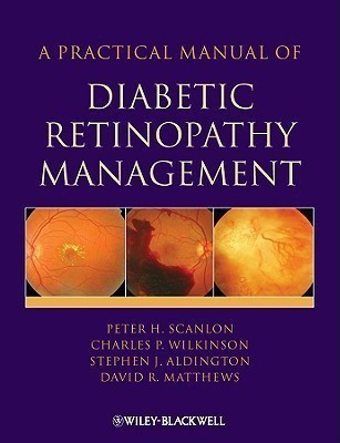 A Practical Manual of Diabetic Retinopathy Management(English, Hardcover, Scanlon P)