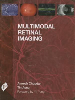 Multimodal Retinal Imaging(English, Hardcover, Chopdar Amresh)