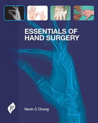 Essentials of Hand Surgery(English, Hardcover, unknown)