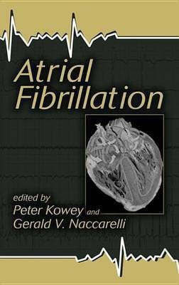 Atrial Fibrillation(English, Electronic book text, unknown)
