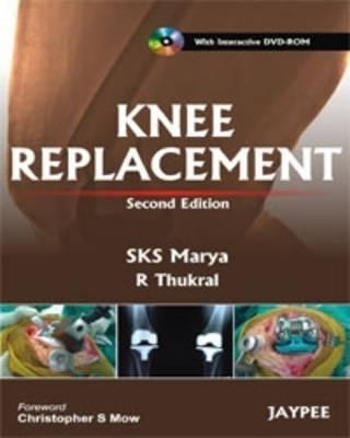 Knee Replacement(English, Hardcover, Marya SKS)