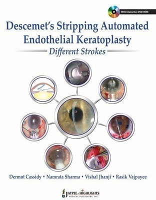 Descemet's Stripping Automated Endothelial Keratoplasty: Different Strokes(English, Hardcover, Cassidy Dermot)