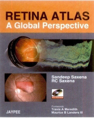 Retina Atlas - A Global Perspective(English, Mixed media product, Saxena Sandeep)