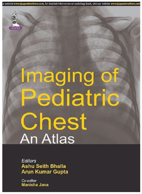 Imaging of Pediatric Chest - An Atlas(English, Paperback, Bhalla Ashu Seith)