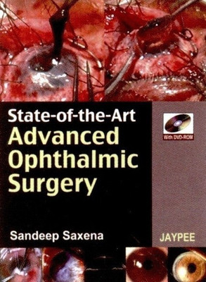 State-of-the Art Advanced Ophthalmic Surgery(English, Mixed media product, Saxena Sandeep)