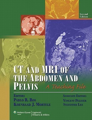 CT and MRI of the Abdomen and Pelvis(English, Hardcover, unknown)