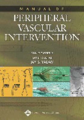Manual of Peripheral Vascular Intervention(English, Paperback, unknown)