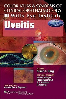Color Atlas and Synopsis of Clinical Ophthalmology - Wills Eye Institute - Uveitis(English, Paperback, Garg Sunir J.)