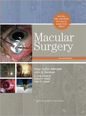 Macular Surgery(English, Hardcover, Quiroz-Mercado Hugo)
