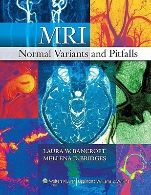 MRI Normal Variants and Pitfalls(English, Hardcover, unknown)