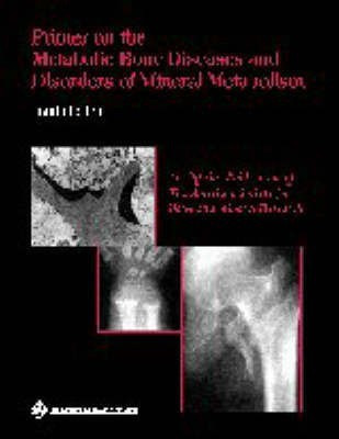 Primer on the Metabolic Bone Diseases and Disorders of Mineral Metabolism(English, Paperback, unknown)