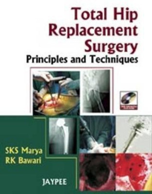 Total Hip Replacement Surgery(English, Mixed media product, Marya SKS)