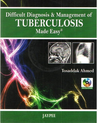 Difficult Diagnosis and Management of Tuberculosis Made Easy(English, Mixed media product, Ahmed Tosaddak)